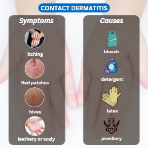 contact dermatitis symptoms and causes