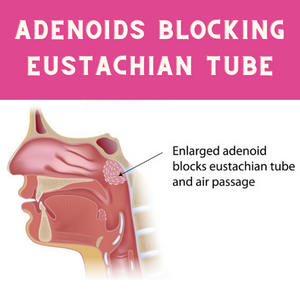 adenoid auditory tube
