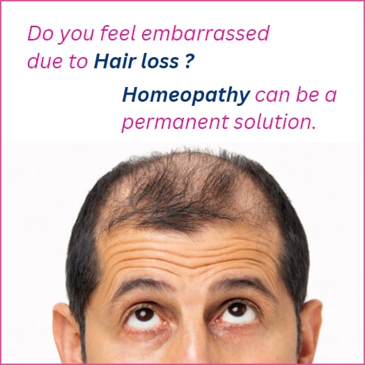 Try Homeopathy for hair loss