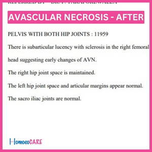 Successful Homeopathic Treatment of Avascular Necrosis