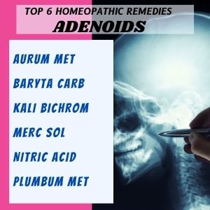Top 6 Homeopathic medicines for Adenoids