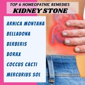 Top 6 Homeopathic medicines for Kidney Stone