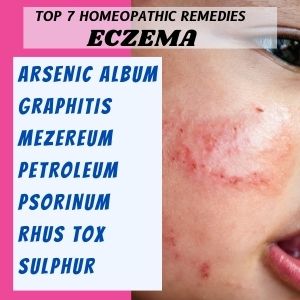 Top 7 Homeopathic medicines for Eczema