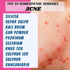 Top 10 Homeopathic medicines for Acne
