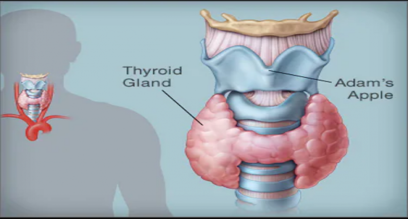 Hypothyroidism_2