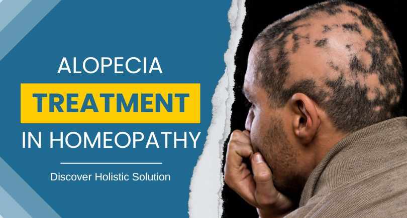 Alopecia_Treatment_In_Homeopathy