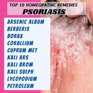 HOMEOPATHICREMEDIESFORPSORIASIS