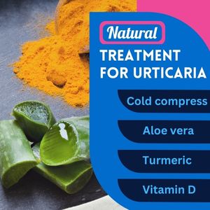 NaturaltreatmentforUrticaria