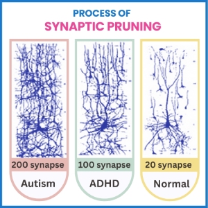 ADHD Vs Autism Key Differences Connection Explained ADHD Vs Autism Key Differences Connection Explained