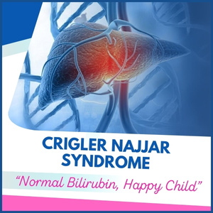 crigler najjar sydrome