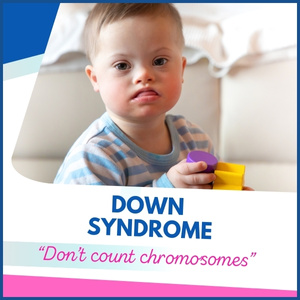 down syndrome (1)