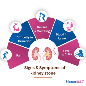 sign and symptomss of kidney stone