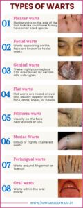 types of warts(1)