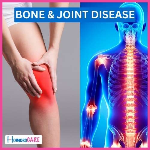 Joint Disease