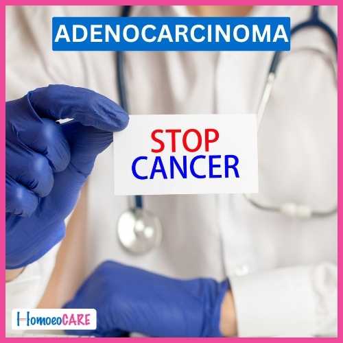 Adenocarcinoma by Homeopathy