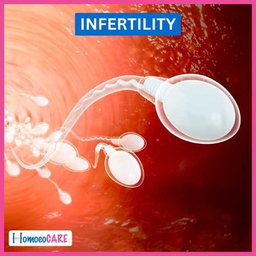 Case study of Successful Treatment of Infertility by Homeopathy