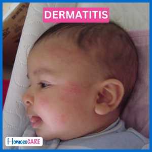 1678708610.dermatitis_after