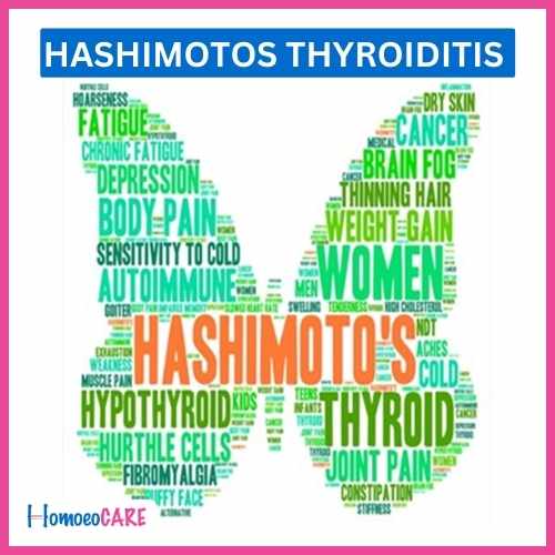 Hashimotos Thyroiditis