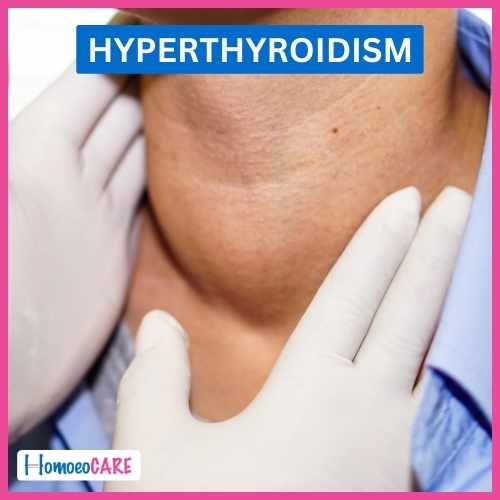 Case study of Successful Treatment of Hyperthyroid in Homeopathy