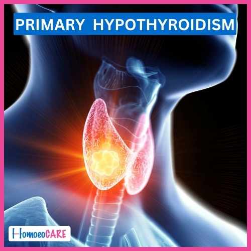 Hypothyroidism by Homeopathy