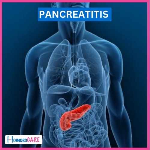 Pancreatitis