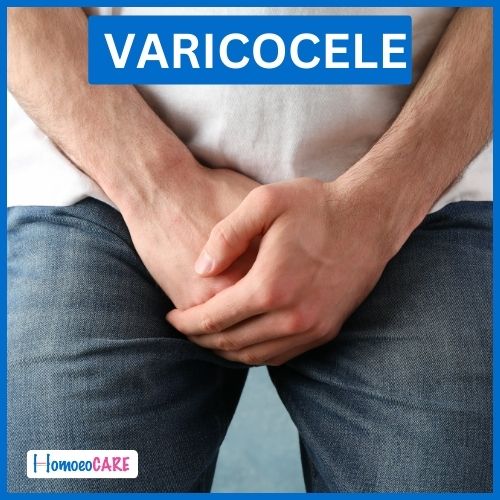 Varicocele