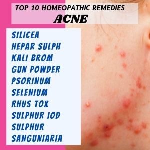 TOP10HOMEOPATHICREMEDIESFORACNE