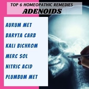 TOP6HOMEOPATHICREMEDIESADENOIDS