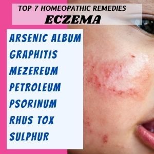 TOP7HOMEOPATHICFORREMEDIESECZEMA