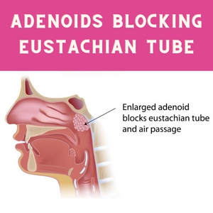 adenoids block eustachian tube