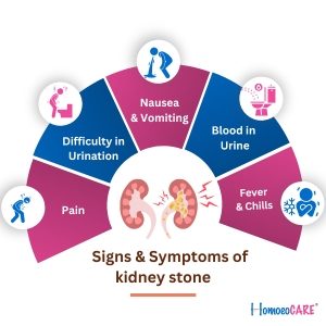 sign and symptomss of kidney stone